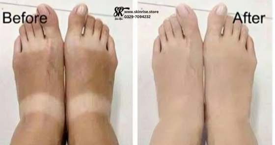 Feet Whitening Cream in Pakistan